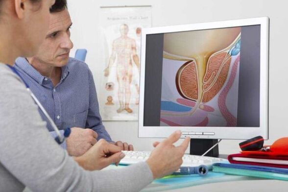 the doctor advises the patient on the issue of prostatitis